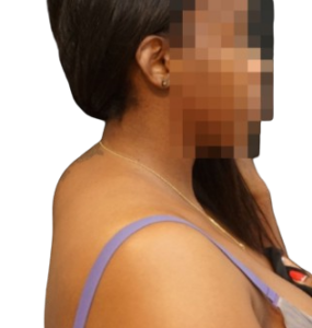 persona con gobba del bisonte